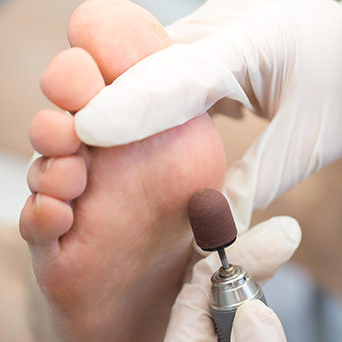 Trattamenti_curativi_piede_1